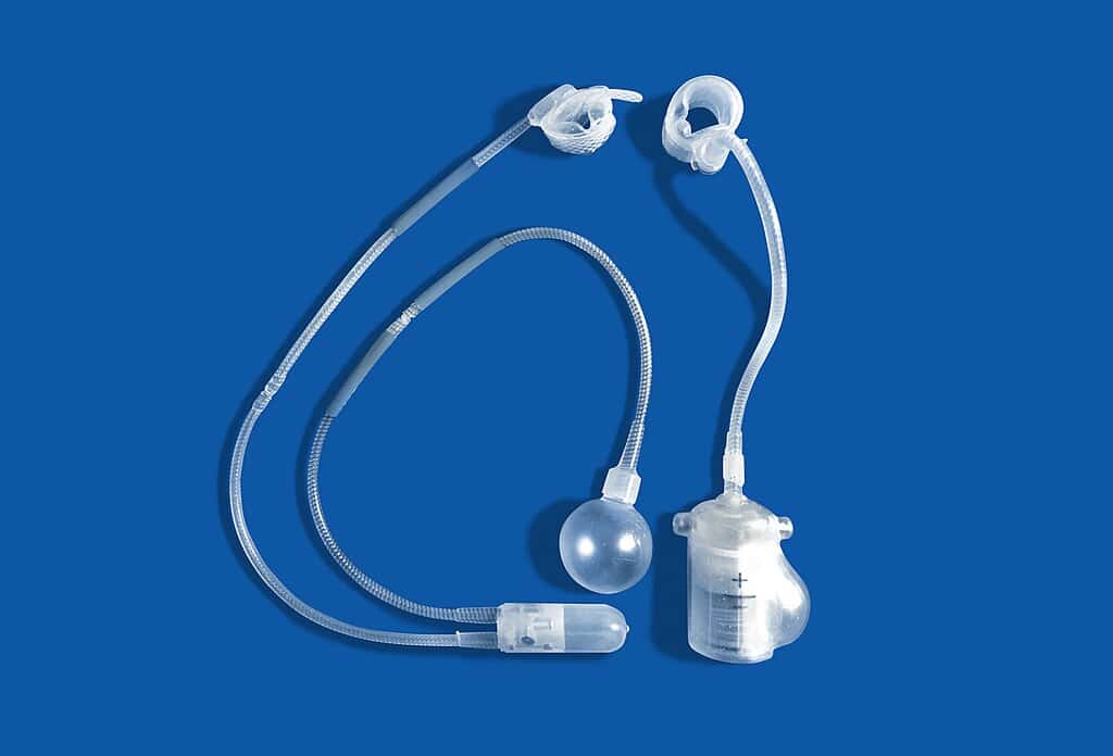 Implante de esfínter urinario artificial para tratar la incontinencia