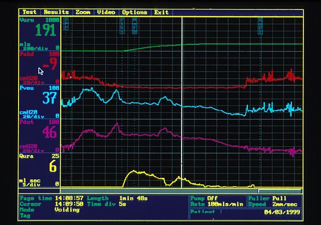 ejemplo de estudio urodinámico
