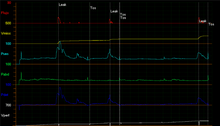 Imagen de estudio urodinamico - Jordán Scherñuk