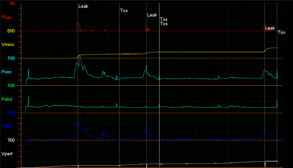 Imagen de estudio urodinamico - Jordán Scherñuk