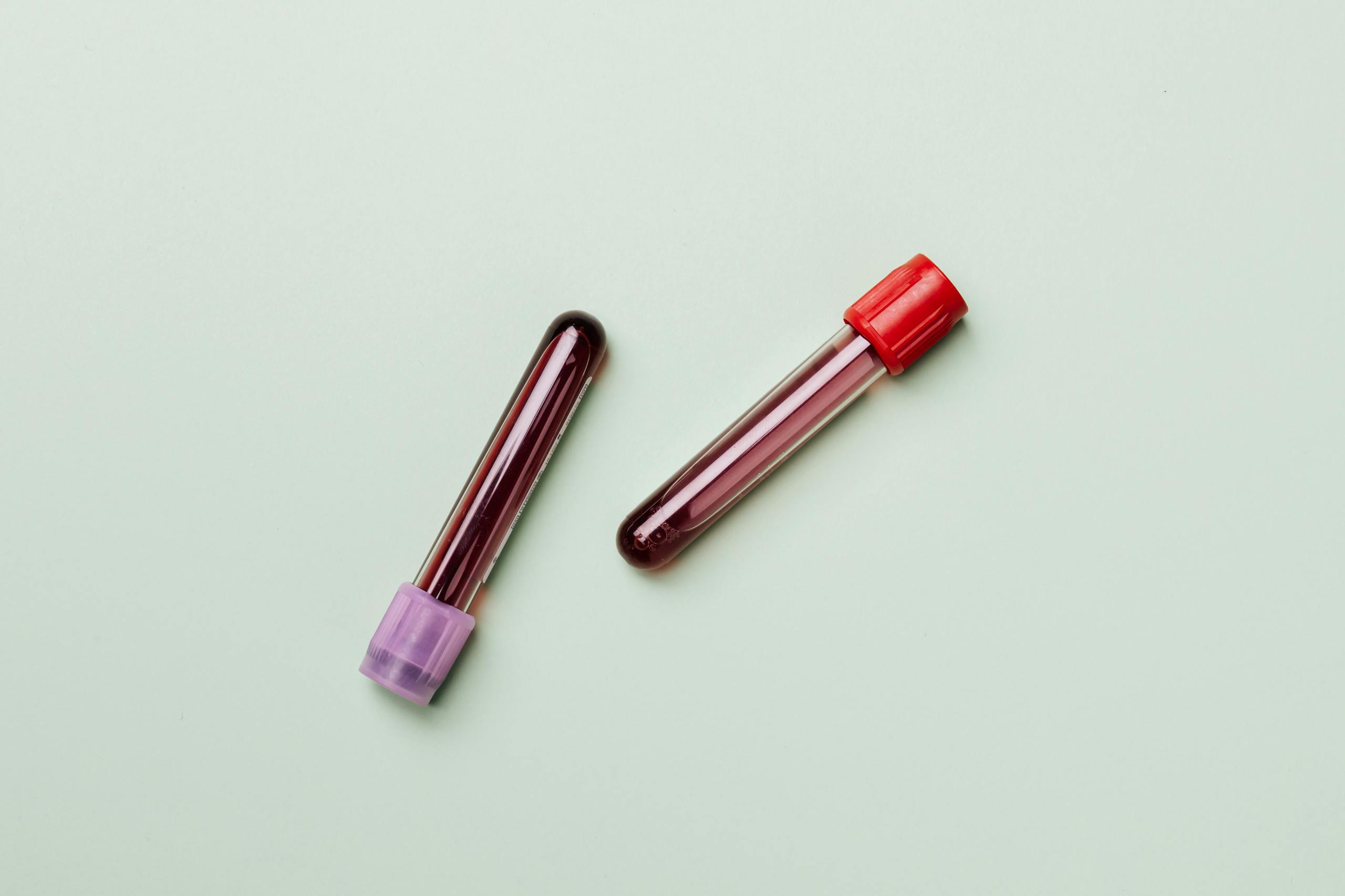 Blood samples in test tubes on a light background, ideal for medical and laboratory themes.