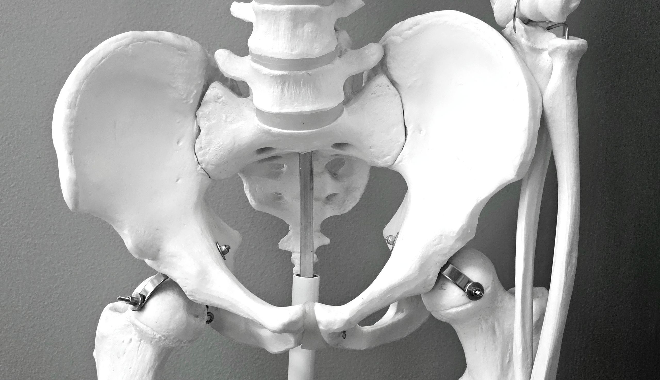 Pelvic trauma